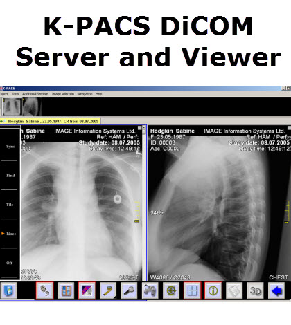 k-pacs viewer for mac